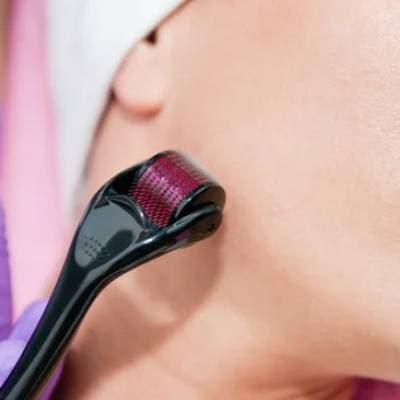 MICRONEEDLING